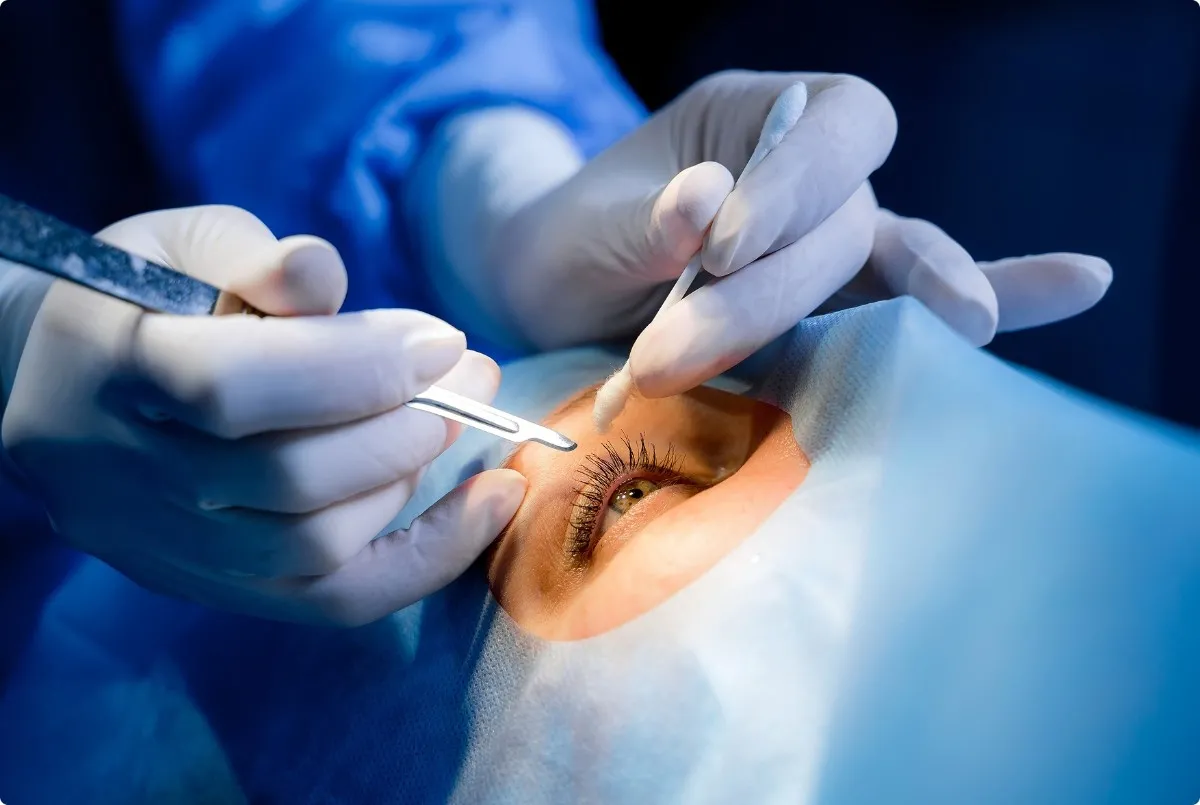 The benefits of lens replacement surgery