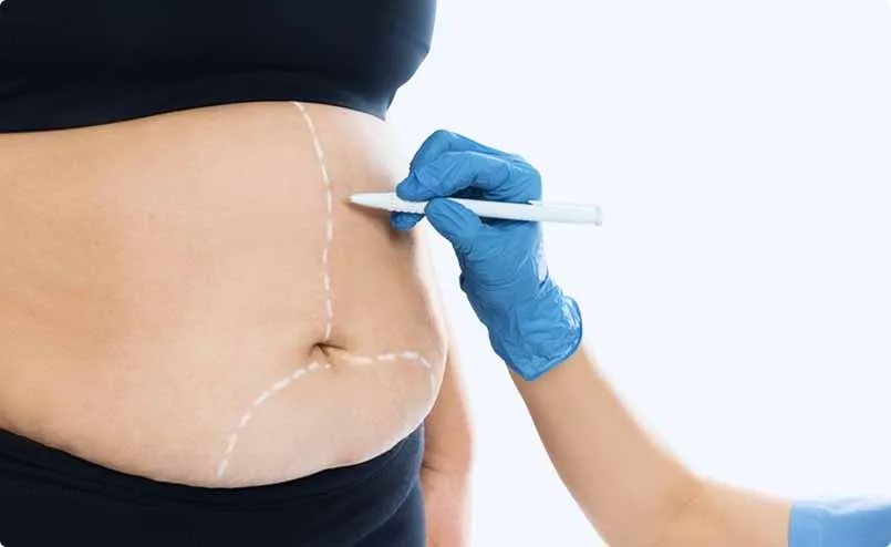 Private Weight Loss Treatment and Bariatric Surgery in Coventry